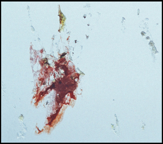 sudden_death_06